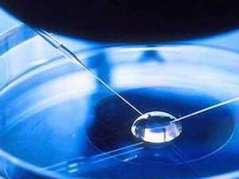 高龄做试管养囊4大好处是什么(高龄做试管失败原因有哪些)